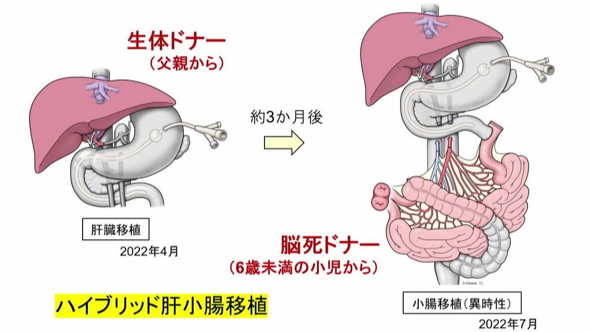 小児肝移植肝臓病アトラス 肝胆膵 (非腫瘍性疾患病理アトラス) | 原田 憲一, 能登原 憲司