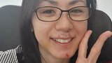 【小島可奈子】犬に顔を咬まれて4針縫う怪我も「なんとかなるっしょ!」 介護&子育て&経営の人生でタフに「生きてるだけで花丸」|TBS NEWS DIG