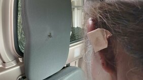 【独自】車内から弾1発見つかる「ちょっとずれれば…。もしかしたら…」運転中の女性の左耳に「猟銃の弾」あたったか… けがをした女性が語った当時の状況 運転中に車の前後のガラスが割れる→直後に左耳に激痛・流血…|TBS NEWS DIG