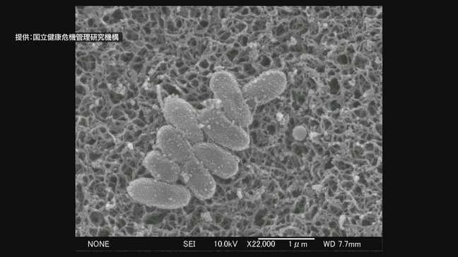 「百日咳」の感染 青森県内で拡大中 1週間の患者は34人で過去最多を更新 |TBS NEWS DIG