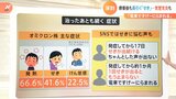 「感染リスクが低い旅行を」医療現場から「お盆のお願い」 療養期間が終わった後も長引く「せき」|TBS NEWS DIG