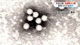 手足口病8週間ぶり増加 前週比48人増 鹿児島県内で流行発生警報が継続中 | 鹿児島のニュース|MBC NEWS|南日本放送