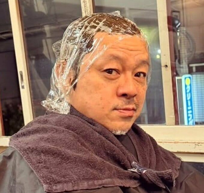 【 水玉れっぷう隊・ケン 】　白髪染めで「アレルギー反応」 「頭皮が無性に痒くなり」「ボリボリしたら、頭皮から透明の汁が」「頭と顔と首が腫れ出して、熱も出だし」|TBS NEWS DIG