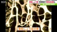 【骨粗しょう症予防】自分の骨密度を70歳前に知り「カルシウムとビタミンDの摂取を」　|　新潟のニュース・天気｜BSN NEWS｜BSN新潟放送