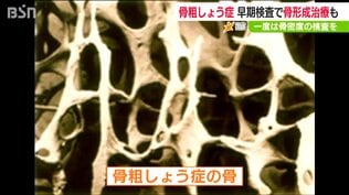 【骨粗しょう症予防】自分の骨密度を70歳前に知り「カルシウムとビタミンDの摂取を」　|　新潟のニュース・天気｜BSN NEWS｜BSN新潟放送