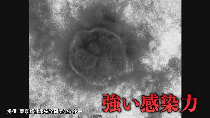 「はしか」ワクチン、何回打ったか確認するには？感染力はインフルの10倍、コロナの3倍以上　|　福島のニュース│TUF