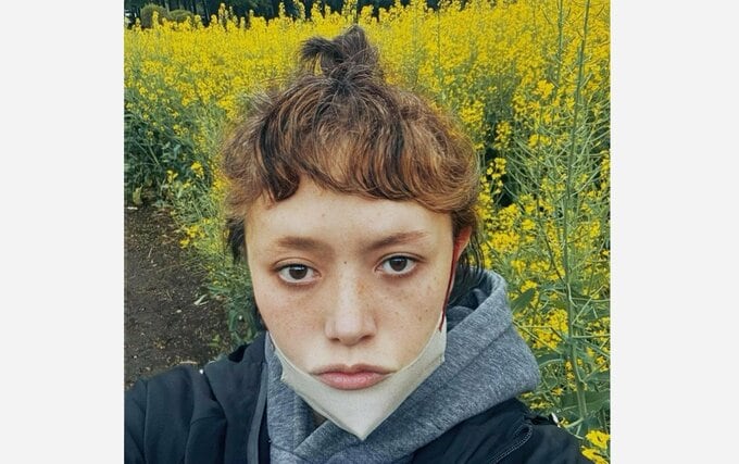 【 広田レオナ 】 「久しぶりに喘息大発作で　救急病院へ」　ＳＮＳで明かす　「東京にいると喘息になるのは何故?」|TBS NEWS DIG