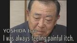 Voices of Nagasaki Hibakusha - YOSHIDA Isao "I was always feeling painful itch"　|　長崎のニュース | 天気 | NBC長崎放送