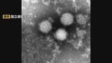 マダニ媒介「SFTS」　県内でことし初感染確認　屋内飼育の4歳の犬に発熱や食欲低下 過去には人への感染事例も 富山|TBS NEWS DIG