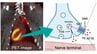 心不全やパーキンソン病の早期診断に向けた新たなPET検査薬を世界初のヒト評価に成功【岡山大学など】　|　岡山・香川のニュース | 天気 | RSK山陽放送