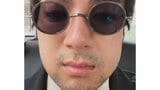 【 山田裕貴 】 親知らず抜歯で“ふにゃふにゃ声”の緊急事態 頬が腫れた自撮り公開にファン「お大事に」「無事に舞台挨拶できますように」|TBS NEWS DIG