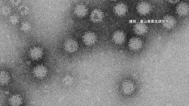 食中毒患者が前年より約7倍に 背景にノロウイルスによる食中毒が増加、患者100人超が複数回発生 富山|TBS NEWS DIG