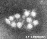仕出し弁当を食べた35人に症状 ノロウイルスによる食中毒が発生 |TBS NEWS DIG
