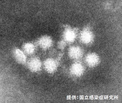 仕出し弁当を食べた３５人に症状　ノロウイルスによる食中毒が発生　|TBS NEWS DIG