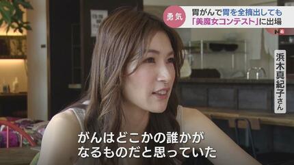 死の淵を乗り越えて今がある」美を追求する胃を全摘出した49歳