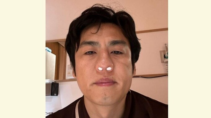 【ロバート】山本ひろしさん 副鼻腔炎「処置名」に困惑「開、大処置なのか？」手術は無事終了|TBS NEWS DIG