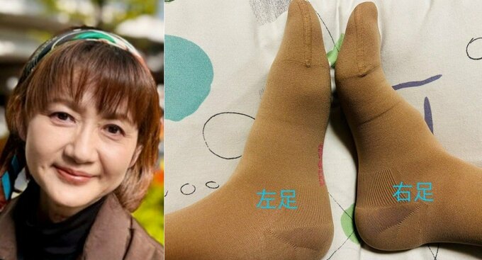 【 がん闘病 】古村比呂さん　リンパ浮腫で「左脚の浮腫みは　足裏に溜まるように」「私の左足は　土踏まずがほぼ　　無くなってます」|TBS NEWS DIG