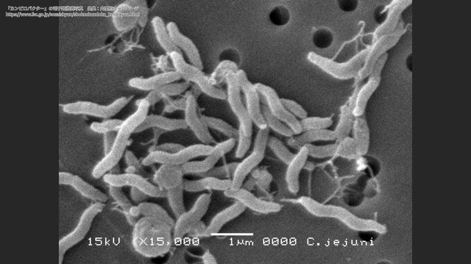 鶏レバー串を食べた8人中8人が下痢や発熱…　「カンピロバクター」による食中毒と特定　飲食店に5日間の営業停止処分　沖縄・嘉手納町|TBS NEWS DIG