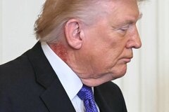 トランプ氏の首に赤い発疹、｢予防的な治療｣とホワイトハウス医師説明| TBS CROSS DIG with Bloomberg