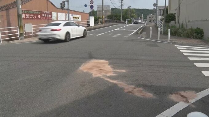 交通事故で骨折した男性…入院不要との診断で帰宅後 体調不良訴え再度病院へ搬送されるも死亡　島根県浜田市　|　BSSニュース | BSS山陰放送