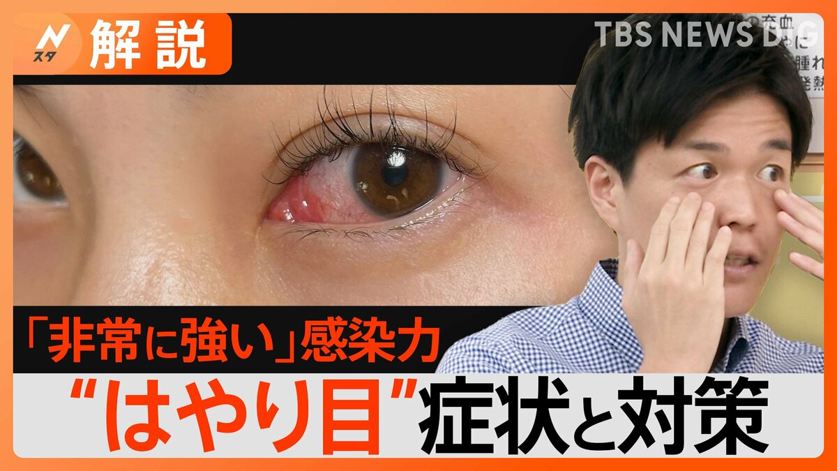 目の感染症 “はやり目”に注意 1か月症状が治らない大人も…家庭内の“感染リレー”を防ぐポイントは？【Nスタ解説】 | TBS NEWS ...