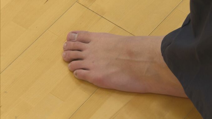 極寒の武道館、道着1枚に裸足…剣道部員も悩まされる「しもやけ」　対策は？|TBS NEWS DIG