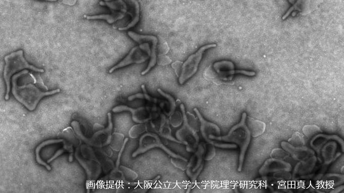 総社市の小学校でマイコプラズマ肺炎の流行による学級閉鎖　夏以降患者が増加傾向で岡山県が感染対策を呼びかけ　|　岡山・香川のニュース | 天気 | RSK山陽放送