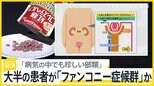“紅麹サプリ”大半の患者が「ファンコニー症候群」か、具体的な症状は？ 4分の3ほどは服用中止で症状改善「必要以上に怖がらず、不調があれば受診を」【news23】|TBS NEWS DIG