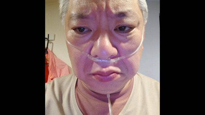 【 鈴木おさむ 】体調不良で救急外来へ「身体しんどくて、１日が長い！！」　27日には『無呼吸睡眠検査』で“チューブ姿”投稿も|TBS NEWS DIG