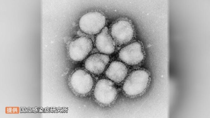 インフルエンザ大流行　「薬不足」「コロナとの同時流行」にも警戒　|　BSSニュース | BSS山陰放送