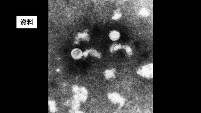 手足口病、警報レベル続く　マイコプラズマ肺炎も増加　福島・9日発表　|　福島のニュース│TUF