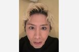 【 ONE OK ROCK 】TAKA　ライブ中に足の小指を骨折　レントゲン写真添え「ポッキリ。。。」　北海道・大阪公演は「絶対やってみせます」　決意明かす|TBS NEWS DIG