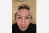 【 ONE OK ROCK 】TAKA ライブ中に足の小指を骨折 レントゲン写真添え「ポッキリ。。。」 北海道・大阪公演は「絶対やってみせます」 決意明かす|TBS NEWS DIG