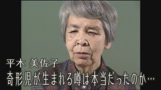「奇形児が生まれる噂は本当だったのか・・・」ヒバクシャの声#27平木美佐子|TBS NEWS DIG