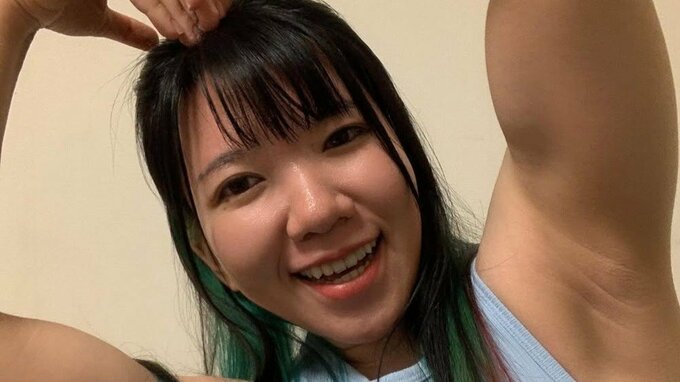 【 マッスルオペラちゃん 】 「『アーノルド・キアリ奇形』という脳の病気で手術を受けるため、しばらく休養いたします」|TBS NEWS DIG