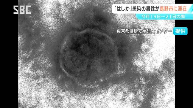 「はしか」に感染 神奈川県の男性が長野市に滞在 1月19日から21日まで 感染力が非常に強く市が注意呼びかけ |TBS NEWS DIG