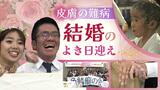 「理解してくれる人は、必ずいる」皮膚の難病“魚鱗癬”の青年 幸せの日を迎えて決意 | 福岡のニュース|RKB NEWS|RKB毎日放送