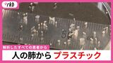 人の肺からプラスチック「解析したすべての患者から検出された」粒子濃度が高いほど炎症値も大きい結果　医師や研究者の解析で明らかに　|　福岡のニュース｜RKB NEWS｜RKB毎日放送