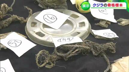 胃袋から出てきた1円 なから
