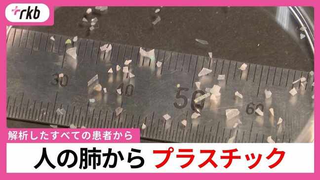 人の肺からプラスチック「解析したすべての患者から検出された」粒子濃度が高いほど炎症値も大きい結果 医師や研究者の解析で明らかに|TBS NEWS DIG
