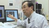 「今の状態を保てるのではないか」アルツハイマー病で期待の新薬 対象者の条件と費用 | 山梨のニュース | UTYテレビ山梨