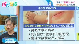 「コロナ」「手足口病」が猛威 「熱中症」と同時発症も　“のどの症状”に要注意【ひるおび】|TBS NEWS DIG