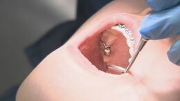 口の乾燥「ドライマウス」唾液が減って細菌が増える…インフルや肺炎のおそれも　“危険な人”と“予防策”を医師に聞く|TBS NEWS DIG