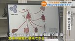 少量のウイルスが残り続ける「持続感染」も…新型コロナ“第7波”拡大で専門家が警鐘 体内でずっと感染が続いて“後遺症”に? | 名古屋・愛知・岐阜・三重のニュース【CBC news】 | CBC web