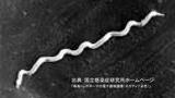 梅毒患者の報告数 1981年以降 過去最多「増加の要因は不明」【長崎県】 | 長崎のニュース | 天気 | NBC長崎放送