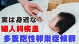 思春期からの月経不順 受診の遅れで不妊につながる可能性も 実は身近な婦人科疾患「多嚢胞性卵巣症候群」とは? | 沖縄のニュース|RBC 琉球放送