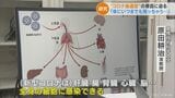 少量のウイルスが残り続ける「持続感染」も…新型コロナ“第7波”拡大で専門家が警鐘 体内でずっと感染が続いて“後遺症”に?|TBS NEWS DIG