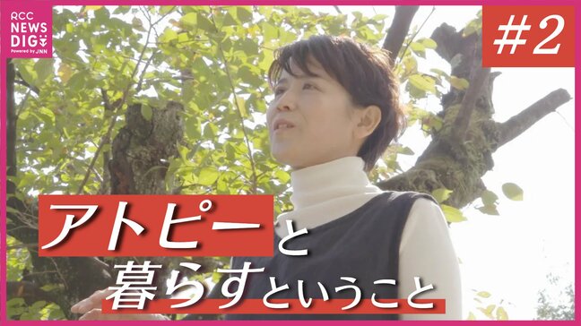 50代で再び訪れたアトピーの“激しい再燃” 顔から汁がにじむ絶望 「何を着てもかゆい」救いとなったのは自ら作った“寄り添う下着”(全3回の2回目)|TBS NEWS DIG
