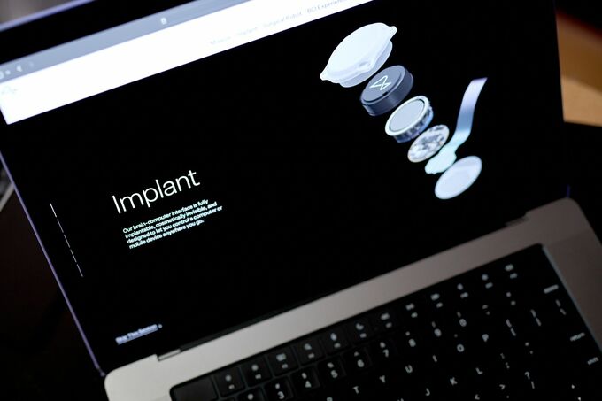 脳チップでサルに実在しない物「見せる」実験成功－ニューラリンク