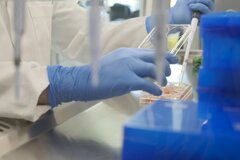 うつ病治療薬開発デフィニウム、株価50％急伸－「画期的」な治験結果| TBS CROSS DIG with Bloomberg